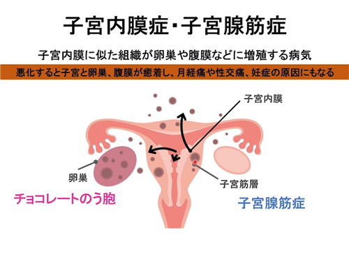 第2部イメージ