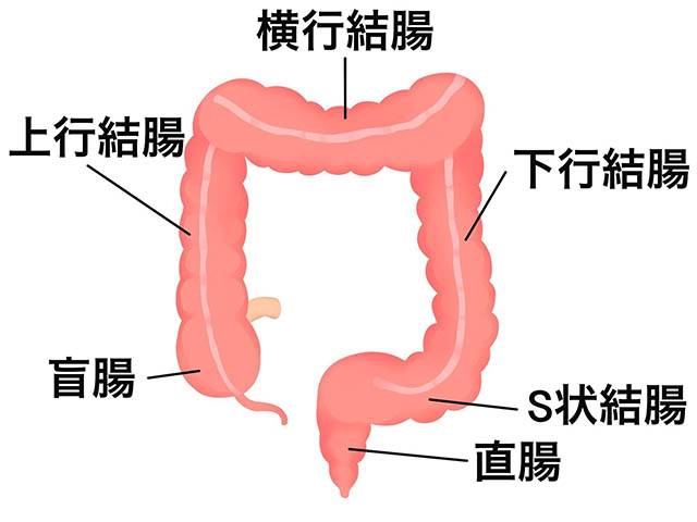 大腸がんの原因や予防、薬物治療についての画像