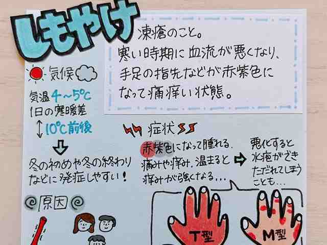 春先も要注意!しもやけの原因と治療薬の画像